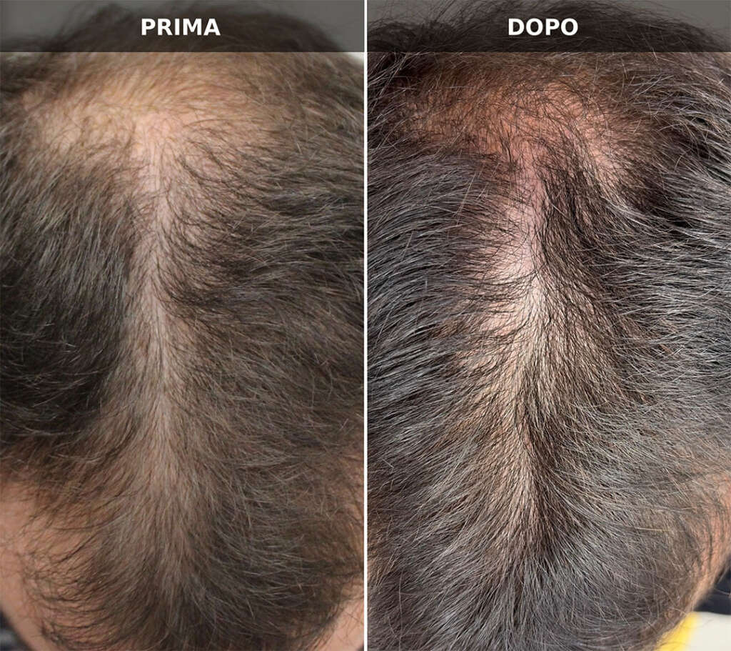 dermatologo capelli Salerno